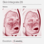 Skin Integrate 28 ελλαδα