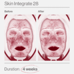 Skin Integrate 28 ελλαδα