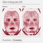 Skin Integrate 28 ελλαδα