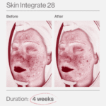 Skin Integrate 28 ελλαδα