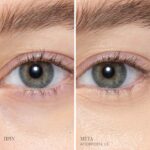 L3 Main Editable BAs