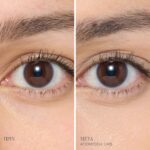 LM5 Main Editable BAs